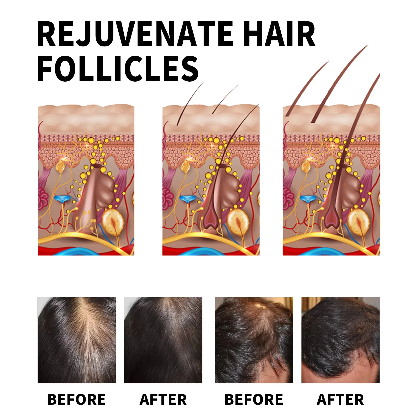 Ginger Hair Growth Products Fa - Hair Care For Dry And Frizzy Hair recension och pris